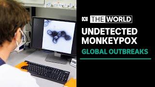 Disease experts say data indicates at least two separate Monkeypox outbreaks underway | The World