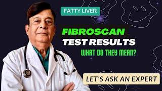 Liver FibroScan Test Results | Fatty Liver | Fibroscan of Liver Normal Range | Fatty Liver Treatment