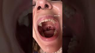 Mouth tour part 3