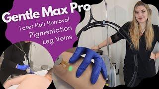 Gentle Max Pro: The Ultimate Solution for Hair Removal, Pigmentation, and Leg Veins