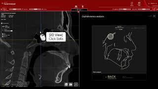 6. [R2GATE 2 0 manual] Facial analyzer (EN)