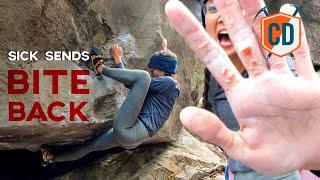 Blood, Sweat And Climbing | Climbing Daily Ep.1832