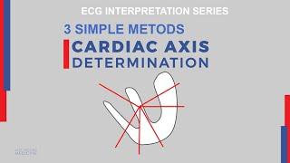 Understand Cardiac Axis & How To Calculate on ECG | Background, 3 Methods, Causes of Axis Deviation