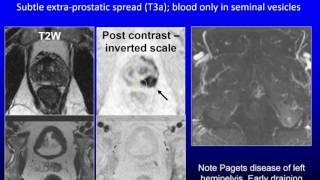 DCE MRI   when to quantify