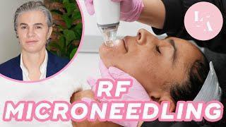 RF Microneedling Treatment FAQs - Who Doesn't Want Tight, Toned & Revitalized Skin?