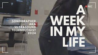 A productive week in my life as a sonographer 2024 (ultrasound technologist)