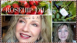 Rosehip Seed Oil - My 4 Year Results w/ Pictures Before & After - How To Use For Anti-Aging