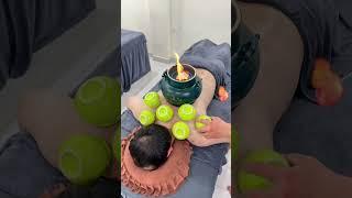 Have you ever tried Cupping ? #asmr #youtubeshorts #massage #china #viral