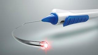 iTrack Advance: advancing canaloplasty to the next level