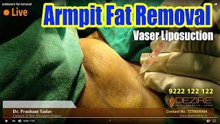 Eliminate Fat Under the Armpits | Get Rid Of Armpit Fat | Lose Armpit Fat