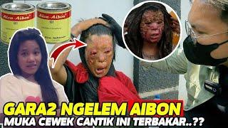 VIRAL DI BATAM !! MUKA YANI SI CEWEK CANTIK INI TERBAKAR GARA GARA NGELEM AIBON ?? EGO ADRIANO