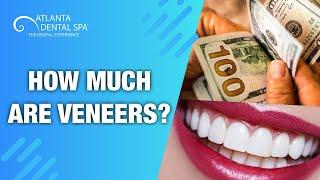 HOW MUCH DO VENEERS COST?