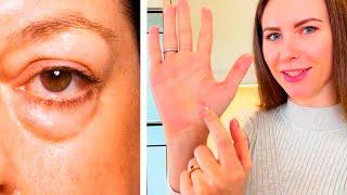 SWELLING? BAGS under your eyes? THESE 3 exercises will help you!