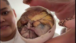 Trying Balut