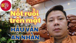 Nốt ruồi son trên mặt,  cuộc sống sung túc, hậu vận an nhàn