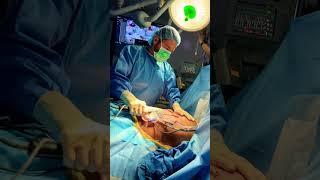 Vaser Liposuction Male gynecomastia surgery Dr. Latin heat