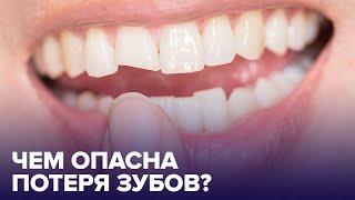 ПОТЕРЯ ЗУБОВ: каковы последствия и как с ними бороться?