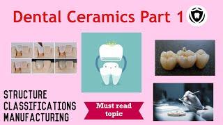 Dental Ceramics : Part 1