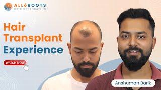 Hair Transplant Journey at AlloRoots - Mr. Anshuman Barik's Transformation