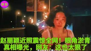 赵丽颖近照震惊全网！眼角淤青真相曝光，网友：这也太狠了