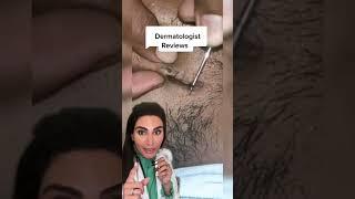 Ingrown Hair #shorts #shortvideo