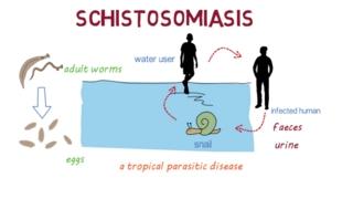 Schistosomiasis (Bilharzia)– an overview