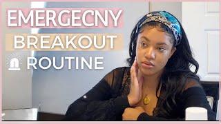 My emergency skin care routine to get rid of acne overnight| How to reduce pimple size FAST!