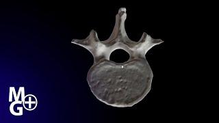 Vertebra lombara L3 (Prezentare 3D- Anatomie)