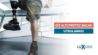 Ottobock prosthetic leg usage performance | Luxmed Protez