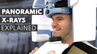 Panoramic Dental X-Ray Procedure EXPLAINED