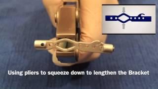 DigiFix® Bracket Adjustment