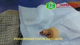 PEMASANGAN CINCIN DAN LEGASI