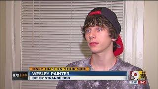 Dog-bitten teen won't need rabies shots after owner comes forward