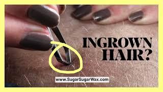 Got Hair? Get Sugar Wax