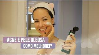 MINHA ROTINA DE CUIDADOS | PELE OLEOSA E ACNEICA por Juliana Goes