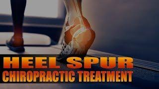 El Paso, TX Sports Chiropractor Heel Spur Treatment