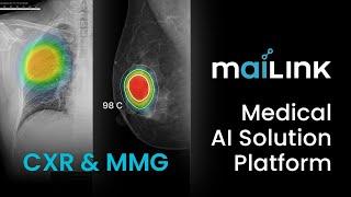 Medical AI Solution Platform : maiLink CXR/MMG