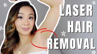 LASER HAIR REMOVAL EXPERIENCE + FAQ | brazillian & underarms