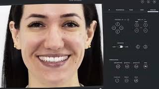 The AI Revolution: 3D Smile Design in Minutes | SmileFy Webinar