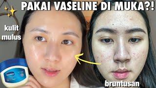 Cobain TEKNIK SKINCARE VIRAL Dari TIKTOK ‘SLUGGING’ Di KULIT BERJERAWAT! Bikin Bruntusan Hilang?!