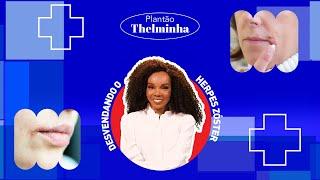 PLANTÃO THELMINHA - Desvendando o herpes zóster