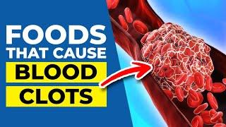 7 Worst Foods that Cause Blood Clots