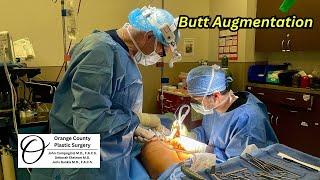 Butt Augmentation | Orange County Plastic Surgery #plasticsurgeon #plasticsurgeryresults