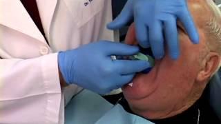 Ivoclar Vivadent Centric Tray with Dr. Frank Lauciello