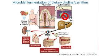 Dissecting the Impact of Gut Microbiome on Human Health by Mass Spectrometry-Based Metabolomics