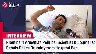 Prominent Armenian Political Scientist and Journalist Details Police Brutality from Hospital Bed