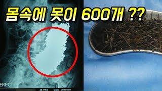 [이슈]못 600개를 먹은 한 남자의 놀라운 사연 - 감동이슈