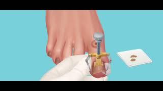 ASMR: Satisfying Patient Treatment Dental and Foot nails cleaning for mood relaxation| Tobjerone TV