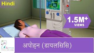 अपोहन (डायलिसिस) | DIALYSIS | Hindi