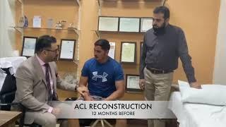 ARTHROSCOPIC ACL RECONSTRUCTION BY DR.UMER BUTT (GREAT RESULT)